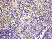 TNFRSF18 staining in mouse lymph node. Formalin-fixed paraffin-embedded mouse lymph node tissue is stained with TNFRSF18 Antibody (Cat. No. 251542) used at 1:200 dilution.
