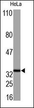 The CDK4 Antibody is used in Western blot to detect CDK4 in HeLa cell lysates.